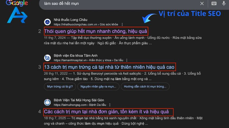Vị trí hiển thị của Title SEO
